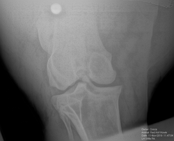 Xray of hock.