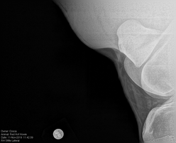 Xray of hock