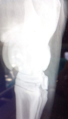 Xray of hock